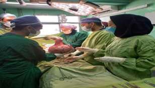 خارج کردن یک توده ۱۰ کیلوگرمی از شکم بیمار در رشت