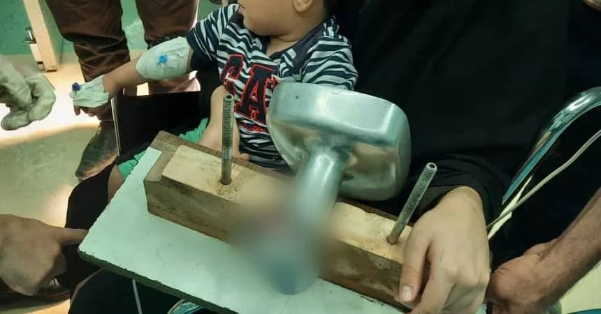 آسیب‌دیدگی دست پسر ۲ ساله بروجنی در چرخ‌گوشت