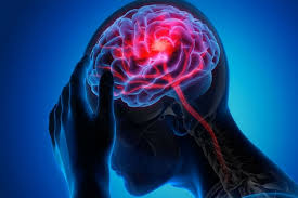 عادتهای مخرب مغز
