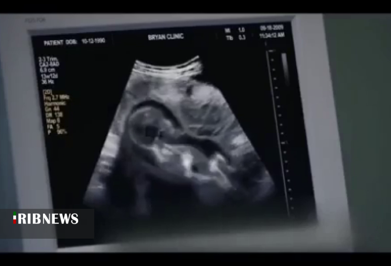 سقط های غیر قانونی، موجب آسیب جمعیتی است