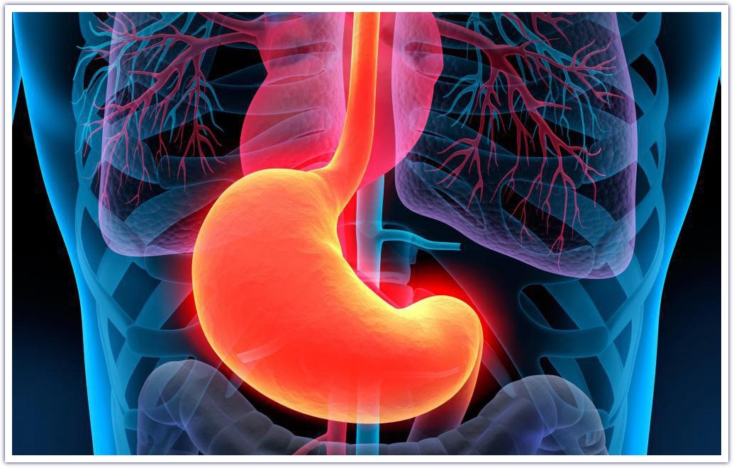 درمان سوزش معده با روش های خانگی