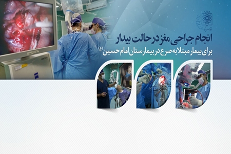 جراحی مغز بیمار مبتلا به صرع در حالت بیدار